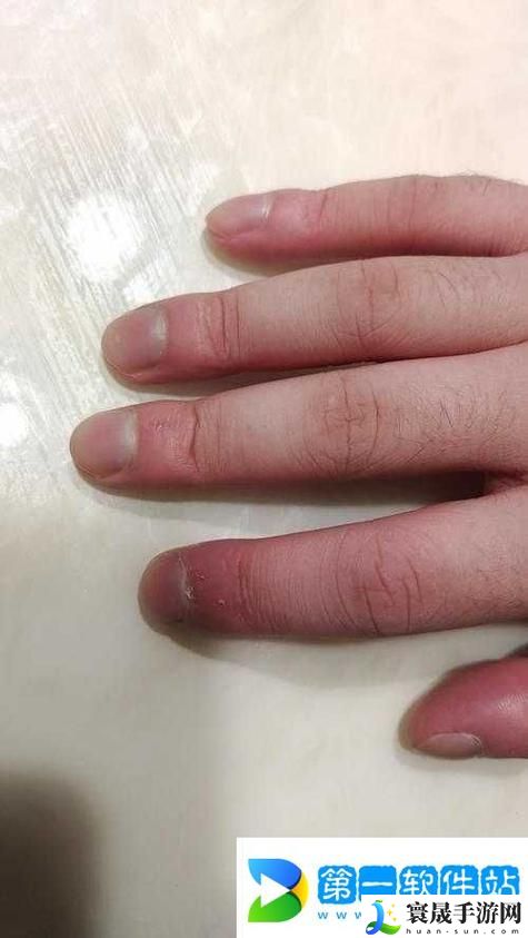 宝宝才两根手指就疼哭了怎么回事